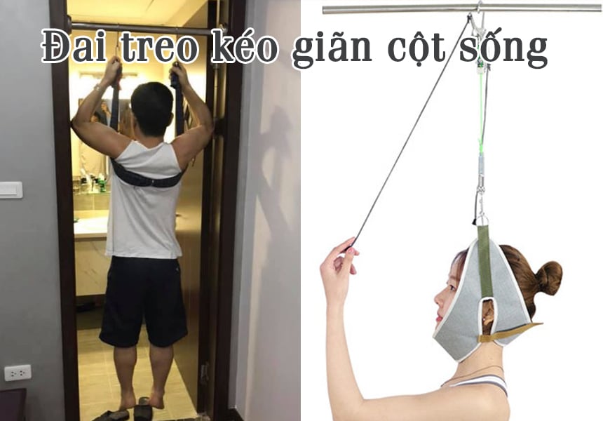 tập xà đơn là cách kéo giãn cột sốt rất tốt