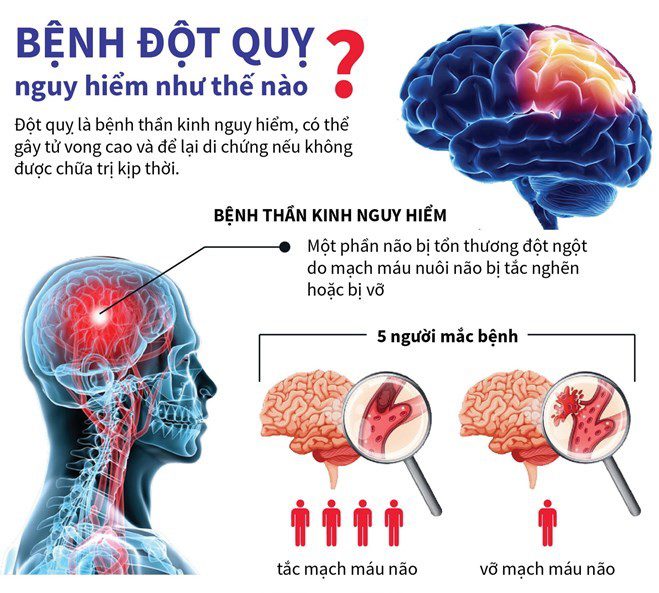 benh dot quy