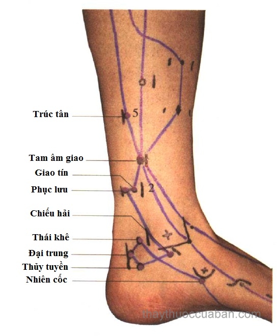 Châm cứu chữa di chứng sau tai biến như thế nào ?