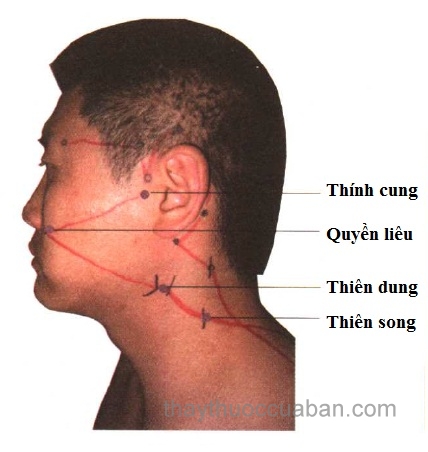 Châm cứu chữa di chứng sau tai biến như thế nào ?