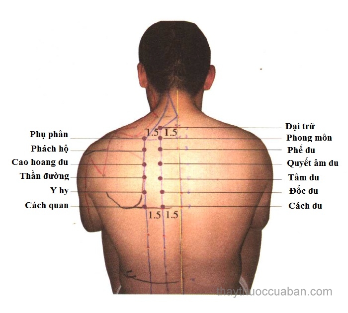 Châm cứu chữa di chứng sau tai biến như thế nào ?